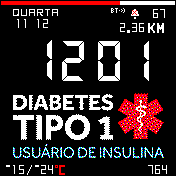 Diabete 1